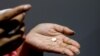 Supreme Court Set To Decide on Abortion Pill Access