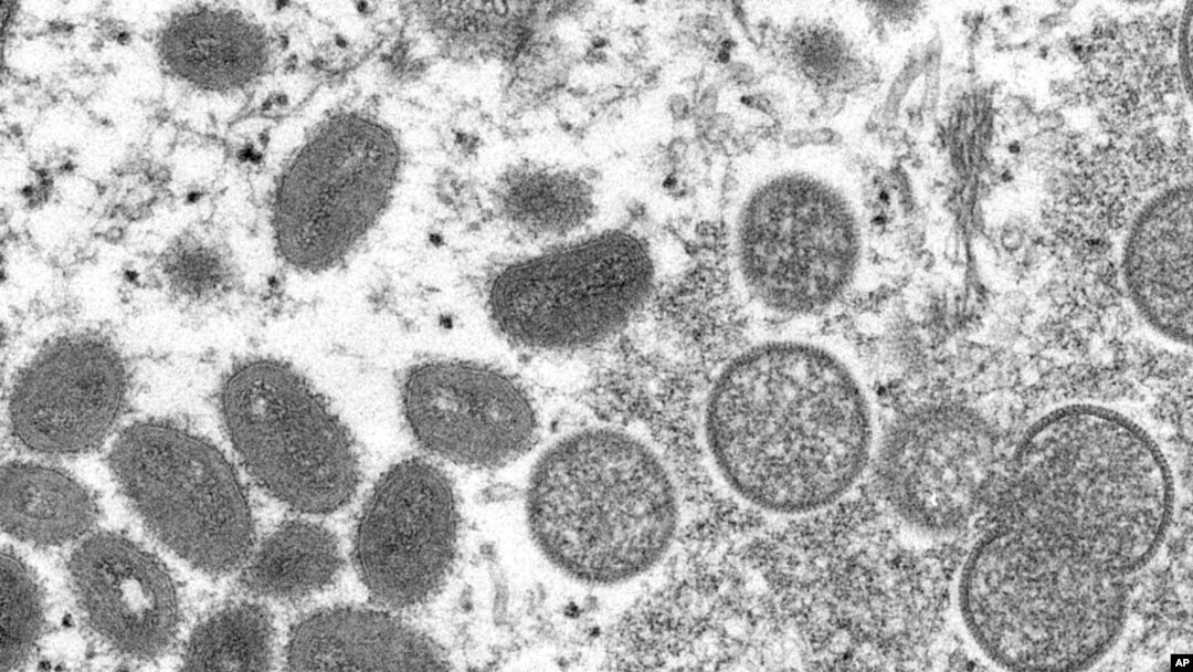 FILE - This 2003 electron microscope image made available by the Centers for Disease Control and Prevention shows mature, oval-shaped monkeypox virions, left, and spherical immature virions, right.