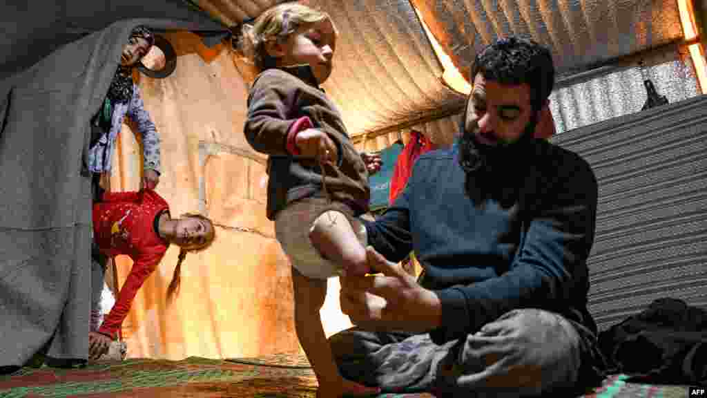 Mohammed, the father of Syrian Maya Merhi, sits next to his disabled toddler, inside the family tent at an Internally Displaced Persons (IDP) camp in Syria's rebel-held northwestern Idlib province, near the Bab al-Hawa border crossing with Turkey.