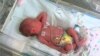 World Prematurity Day Aims to Lower Rates of Premature Births