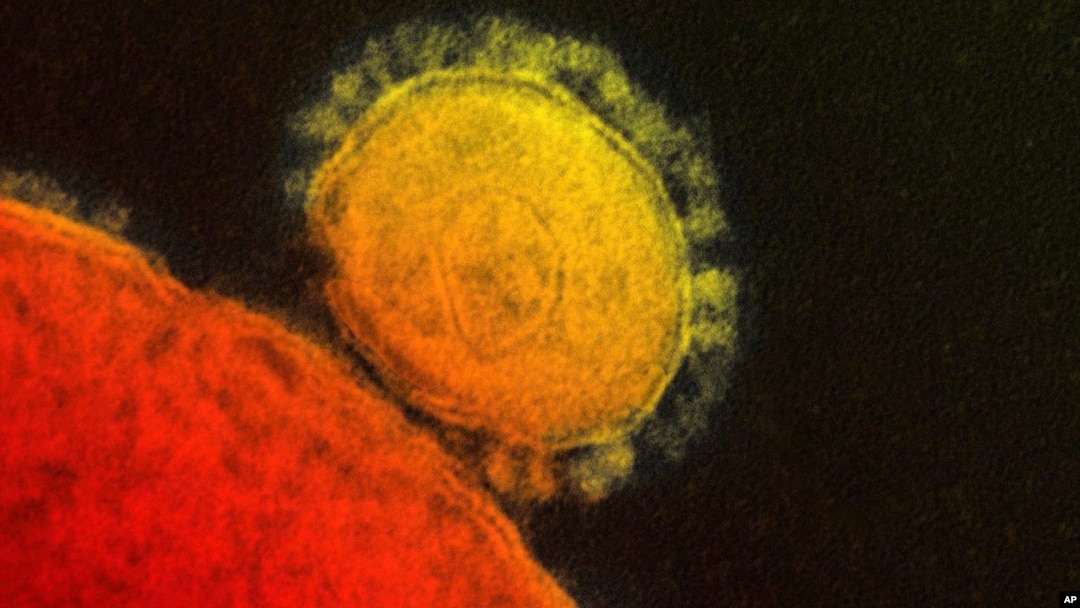 FILE - This file photo provided by the National Institute for Allergy and Infectious Diseases shows a colorized transmission of the MERS coronavirus that emerged in 2012.