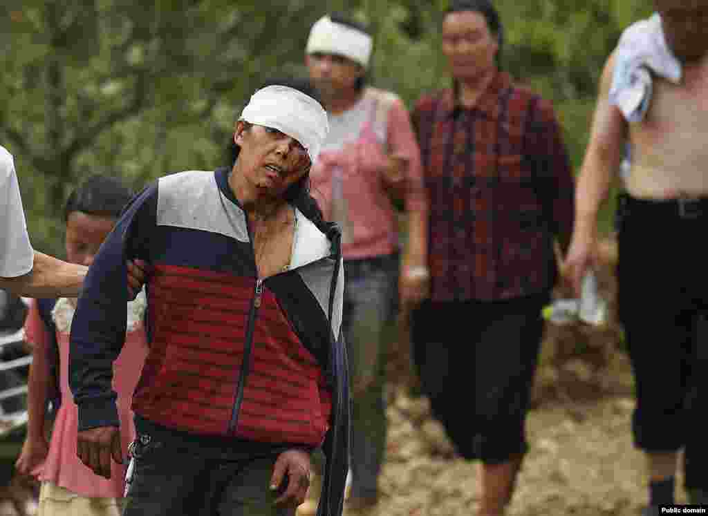 An injured woman walks with her relatives after an earthquake hit Longtoushan township, Ludian county, Yunnan province, Aug. 4, 2014. 