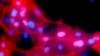 Guidelines Say More Women May Need Breast Cancer Gene Test