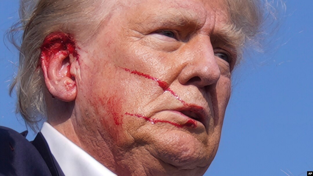 Donald Tramp posle atentata u Batleru, u Pensilvaniji 13. jula 2024. (Foto: AP/Evan Vucci)