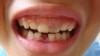 A recent study finds 130 million Americans lack access to affordable dental care.