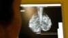 American Nobel: Screen Women for Cancer-Causing Genetic Mutations