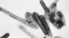 This negative stained transmission electron micrograph (TEM) depicts a number of filamentous Marburg virions. Courtesy: CDC
